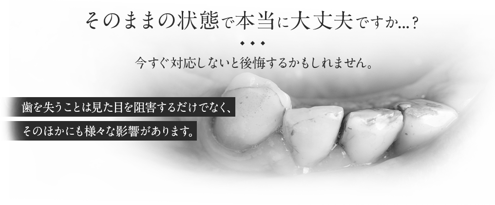 そのままの状態で本当に大丈夫ですか…？今すぐ対応しないと後悔するかもしれません。歯を失うことほあ見た目を阻害するだけでなく、その他にも様々な影響があります。