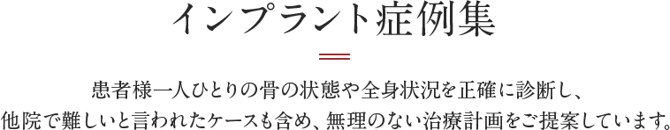 インプラント症例集・患者様一人ひとりの骨の状態や全身状況を正確に診断し、他院で難しいと言われたケースも含め、無理のない治療計画をご提案しています。